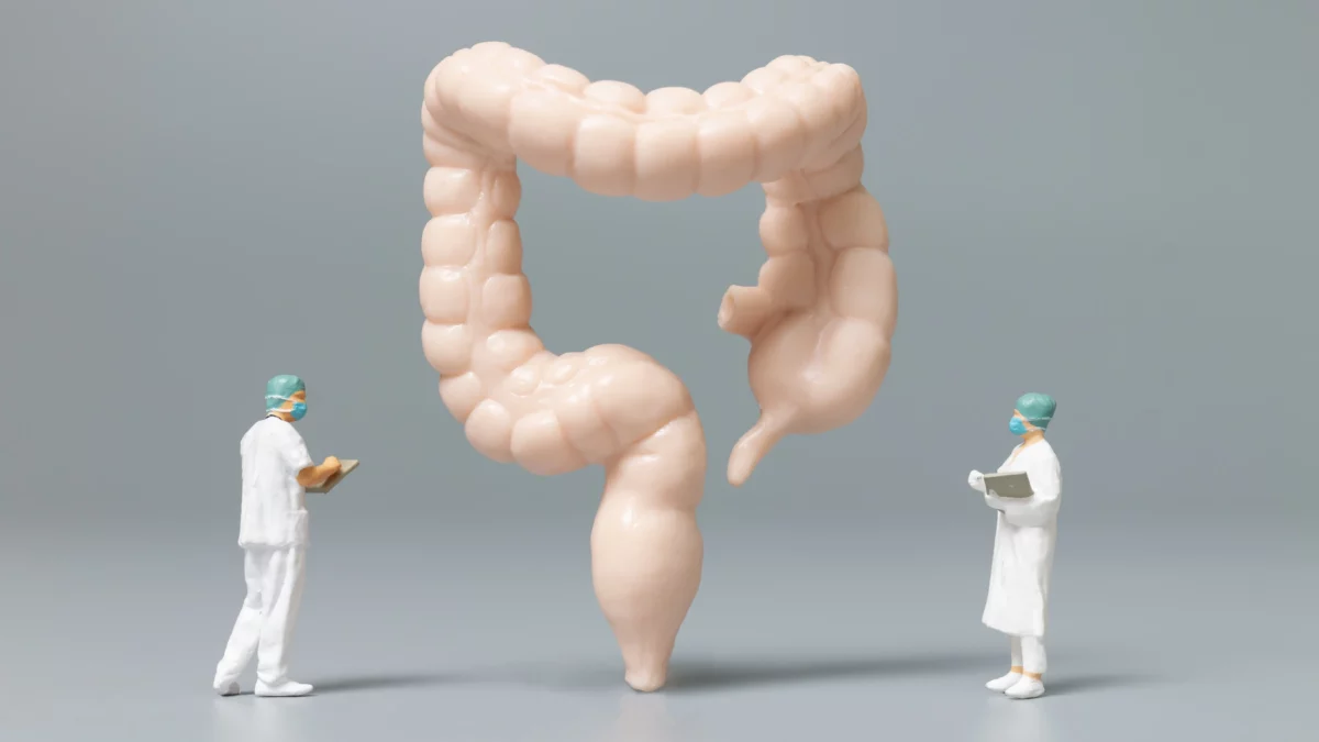 Ten Benefits of a Colonoscopy