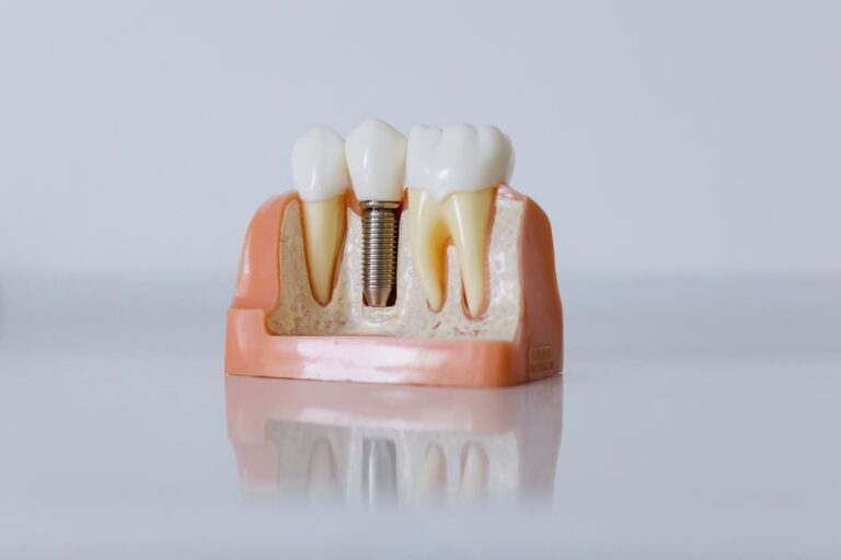 Understanding the Cost of Dental Implants for Seniors: A Comprehensive Guide